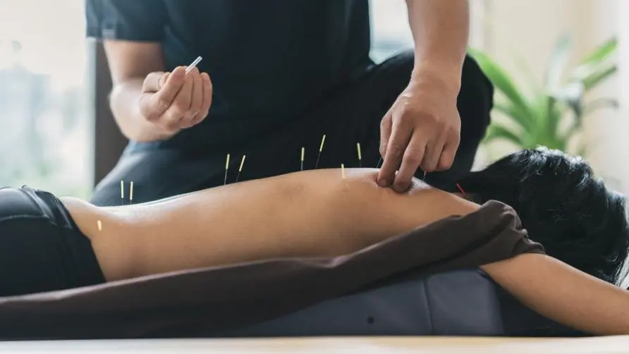 The benefits of acupuncture go beyond pain relief? Chinese medicine practitioners list "8 wonderful uses": It is expected to improve the problems of eczema and nasal allergies