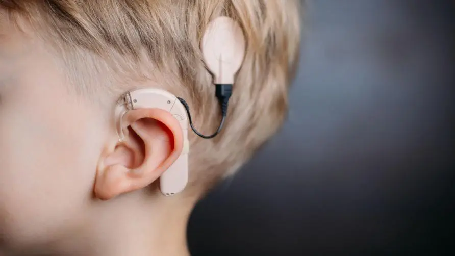 Her "congenital hearing loss" and her pitch pronunciation are no different from those of ordinary people! Doctor: Early implantation of cochlear implants can help hearing-impaired people return to normal life