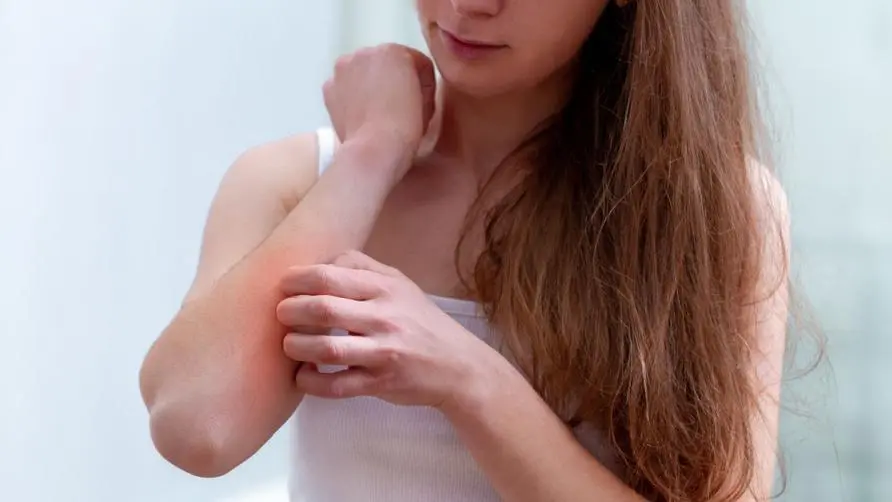 Will eczema break out in spring? Pollen and rainy season may worsen the condition! Experts warn: 6 things that hurt your skin the most