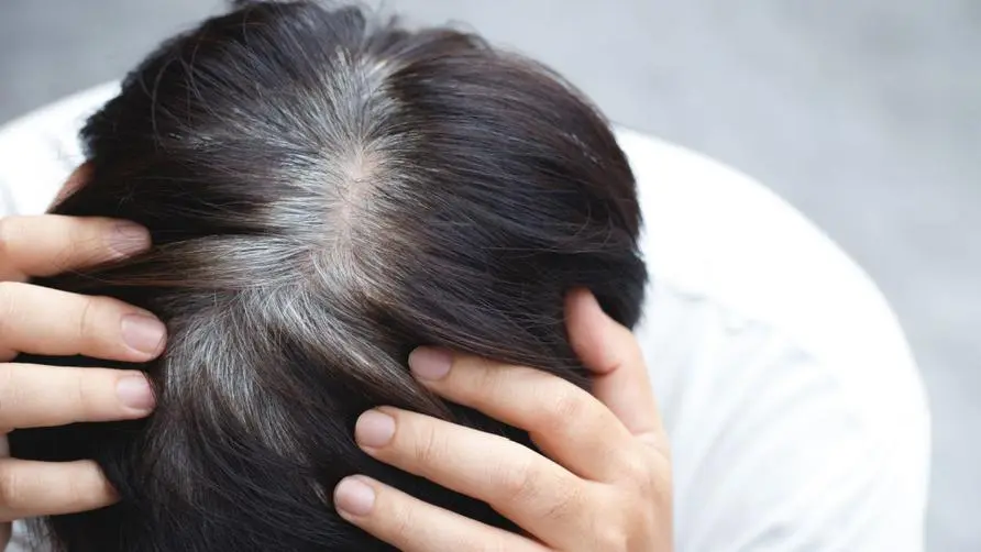 Is gray hair growing on the back of the head a warning sign of "insufficient kidney qi"? Chinese medicine practitioners teach 3 tricks to reverse the "whiteness of prime" dilemma