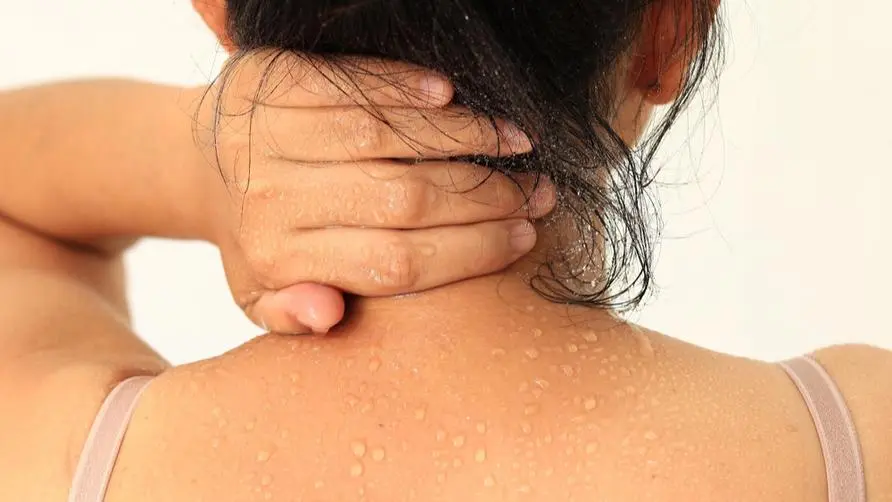 Heavy moisture not only causes edema, but 6 symptoms are caused by the body being too wet! Chinese Medicine Reveals How to Eat to "Clear Heat and Diuresis" in Summer