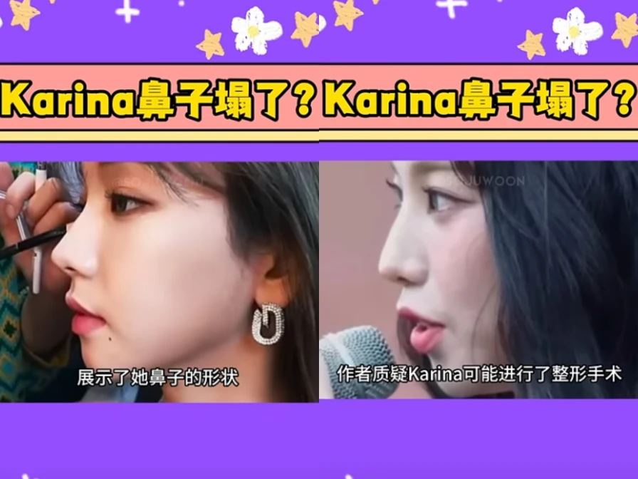 Netizens are talking about the tip of aespa member Karina\'s nose becoming collapsed