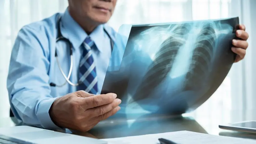 Can lung cancer be detected early? Can AI detect lung nodules? Cathay Hospital\'s actual measurement of 3,000 cases: the accuracy is expected to exceed 90%