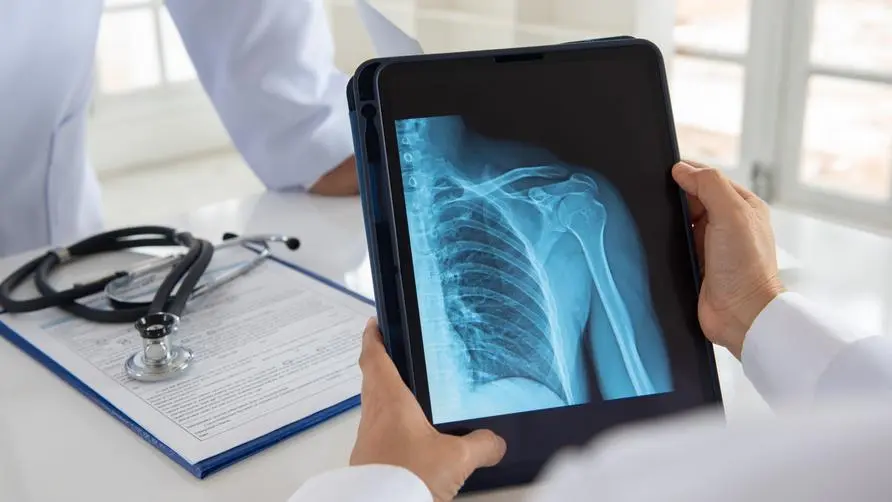 Is the mortality rate of osteoporosis "the same as that of cancer"? Does drinking too much coffee cause bone loss? Doctors reveal the correct way to assess bone health