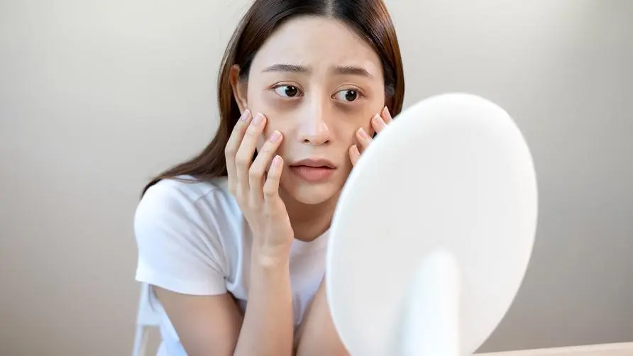 She had severe "dark circles" under her eyes due to long working hours and messy makeup removal, which made her look 10 years older! What should I do if the dark circles under my eyes are getting worse?