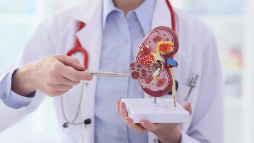 Are there any signs of kidney function falling below 50%? Doctors reveal 6 major risk groups for "chronic kidney disease": Symptoms may be in the terminal stage